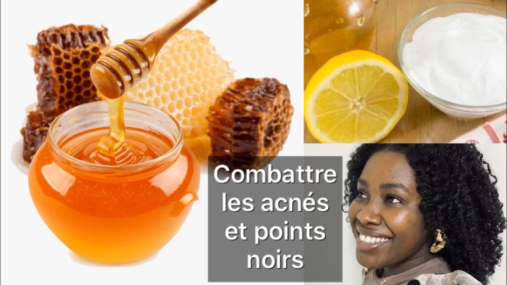 Libérez votre peau des points noirs avec ces astuces naturelles